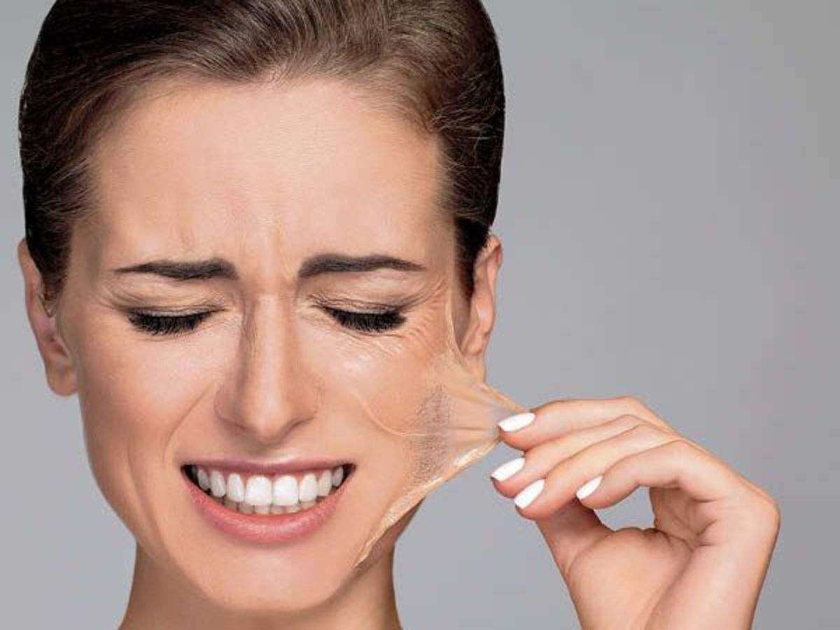 How to Treat Peeling Skin on Face Navtarang